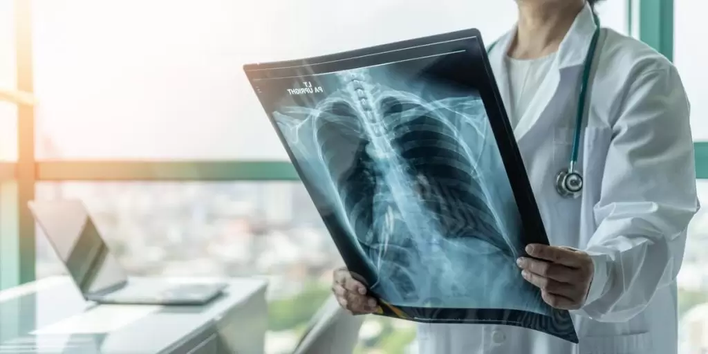 Akciğer Enfeksiyonu Ölüm Riski Taşır mı?