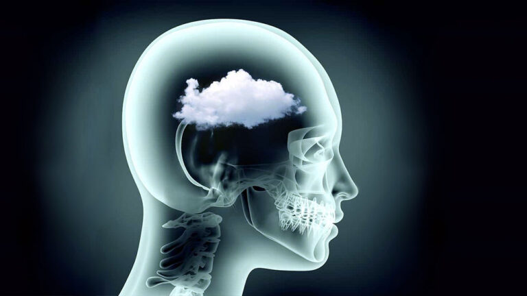 Brain Fog Nedir? Beyin Sisi Belirtileri Nelerdir?