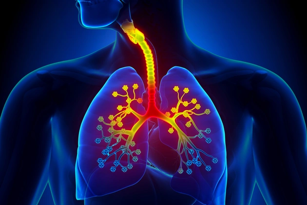 Bronşit Nedir ve Belirtileri Nelerdir? Ne İyi Gelir?
