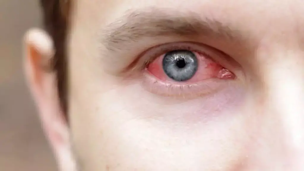 Adenovirüs